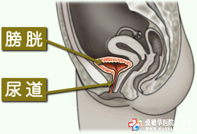 對于膀胱炎該如何治療呢_九江醫大醫院