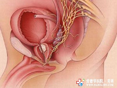 前列腺增生有哪些危害？九江醫大醫院
