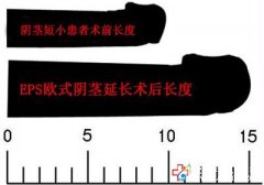 為什么陰莖那么短？應該